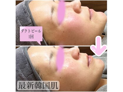 リンク(LiNK)の写真