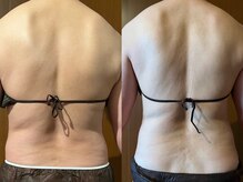 マロカ(Marroka)の雰囲気（40代前半。運動、食事制限なし。エンダ＋若よもぎ蒸し6回のみ）