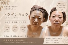 トウゲンキョウ