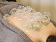 ミノリノモリ(Minorinomori)/吸い玉（カッピング ）