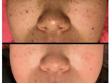 美肌ワークス(美肌works)/効果抜群シミケアお任せください