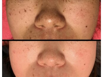 美肌ワークス(美肌works)/効果抜群シミケアお任せください