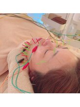 シェリール(Cherir)/〈リフトアップ〉美容鍼×電気鍼