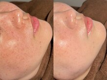 ルーナジェーナ(Luna llena)/池袋　エステ　ルーナジェーナ