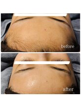 シュガーリングハウス ベル(Bell)/お顔シュガーリング