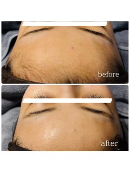 シュガーリングハウス ベル(Bell)/お顔シュガーリング