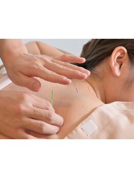 鍼灸施術を受けたい