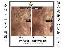 ワンオフルーチェ(one off Luce)/毛穴洗浄でシワ軽減！！