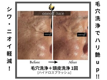 ワンオフルーチェ(one off Luce)/毛穴洗浄でシワ軽減！！