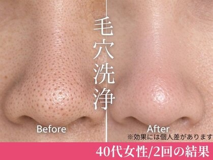 ルージュ(Rouge)の写真