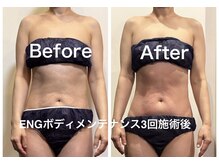 エッセンス(ESSENCE)の雰囲気（☆ENGボディメンテナンス☆驚きの結果です。コリも解消！）
