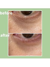 Ms.やまとなでしこ/スーパーチャージゲル使用1週間