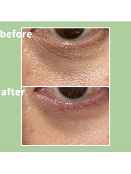 Ms.やまとなでしこ/スーパーチャージゲル使用1週間