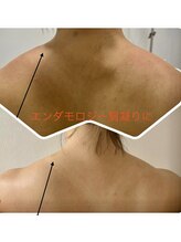 パーフェクトボディ(PERFECT BODY)/エンダモローラーの半端ない威力