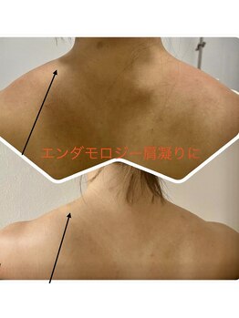 パーフェクトボディ(PERFECT BODY)/エンダモローラーの半端ない威力