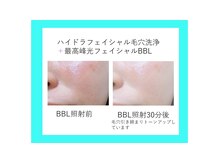 リュクス(LUXE)/