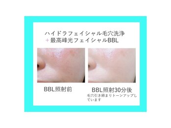 リュクス(LUXE)/
