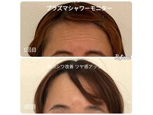 クリニカルエステ リフィーナ 辻堂店の雰囲気（内側から輝くハリツヤ　水光プラズマで毛穴レスで美肌ケア）