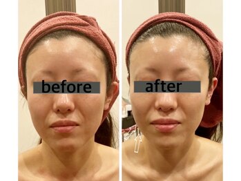 マリスレジーナ 新保店(MarisRegina)/コルギ