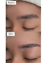 ビュー テンジン 天神 大名(VIEW TENJIN)/アイブロウ（眉毛）ワックス脱毛