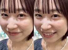 ソリン(Solin')/まつげパーマ