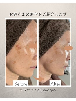 コーヴォ(COVO)/【ホワイトスノーピール】