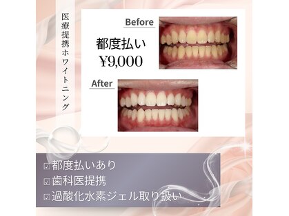プティー(putih)の写真