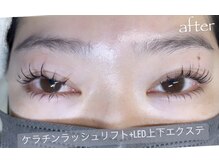 イクアイラッシュ(iku eyelash)/after/LED上下+まつ毛パーマ