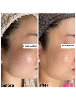 ミュー パピヤン(mue papillant)/ララピール