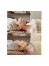 アンバー(Amber)/ Before→After