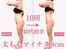 べモーレ 上本町 谷町九丁目(Bemolle)/40代痩身24回ビフォーアフター☆
