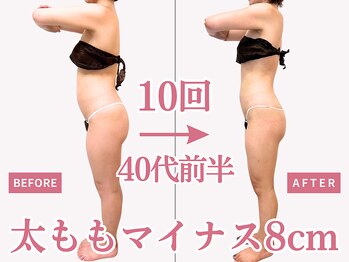 べモーレ 上本町 谷町九丁目(Bemolle)/40代痩身24回ビフォーアフター☆