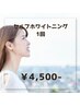 【この価格でこの白さ…通えばわかる実力派！！】 ホワイトニング1回 ¥4,500