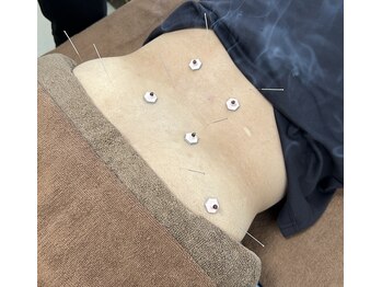 なかざわ鍼灸整骨院/