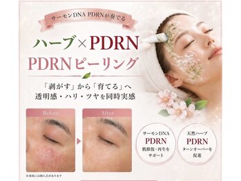 アールビーシー(RbC)の写真/迷ったらコレ！！【PDRNフェイシャル】ハーブピーリングとPDRNで肌質改善！