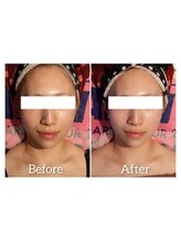 リブメイド(LIB maid)/フォースカッターフェイシャル