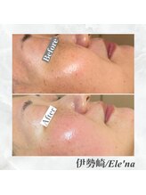 エレナ 伊勢崎(Ele'na)/ガリレオピーリング