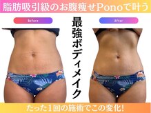 ビューティサロン ポノ(Pono)