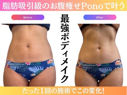 ビューティサロン ポノ(Pono)の写真