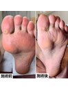 足裏角質ケア