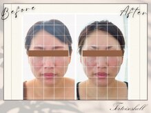 トーティシェル(tortoise shell)/鏡を見るのが楽しくなる♪