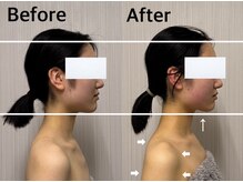 ベール(BEHL)/コルギのBefore After