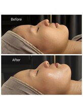 エヌア(nA)/クリスティーナ【アンストレス】