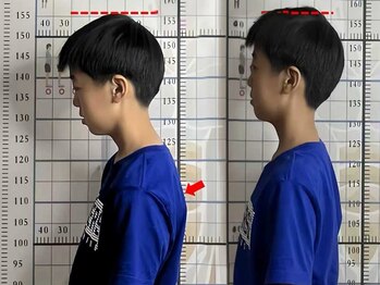 プーラビタ(PURAVITA)/子供の姿勢不良改善