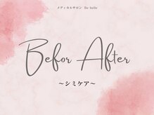 ビベル 八木店(Bebelle)/ビフォーアフター