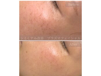 ボウ(Bou)の写真/シミ・シワ改善ケアで年齢に負けない美肌へ◎厳選美容成分で、自信あふれるクリアな素肌をサポート！