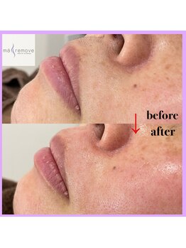 ドラセナ トータルビューティー(Dracaena Total Beauty)/フェイシャルワックス