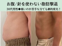 ソルニスデュオ(Solnis.-duo-)/痩身/酵素浴/毛穴/よもぎ蒸し