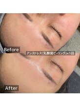 エルエーズ(Elleaise)/赤みを抑えて水光肌！