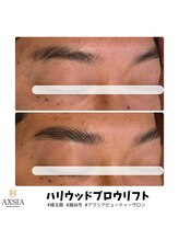 アクシア ビューティー サロン(AXSIA)/【HBL】BeforeAfter